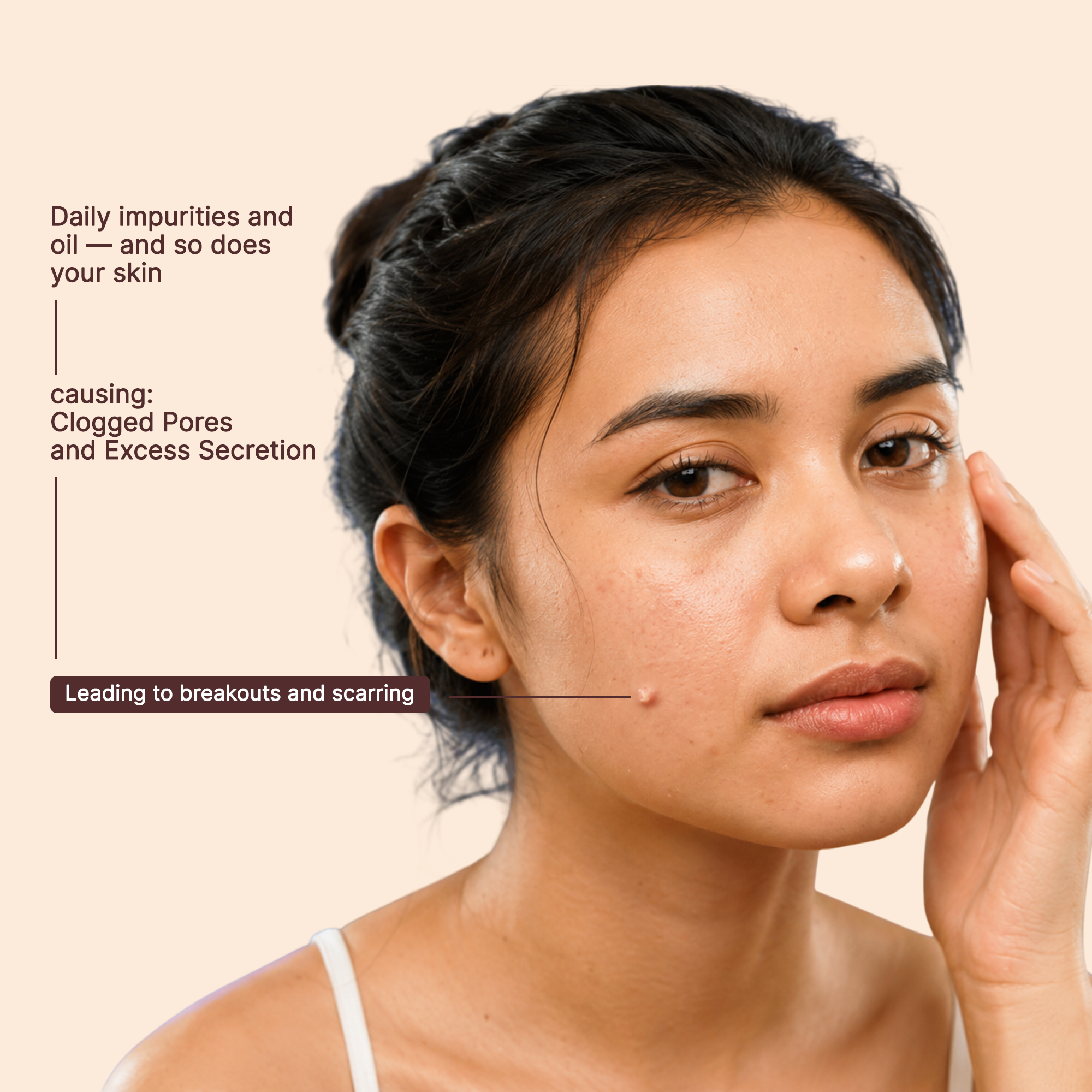 Anti Blemish Patches
